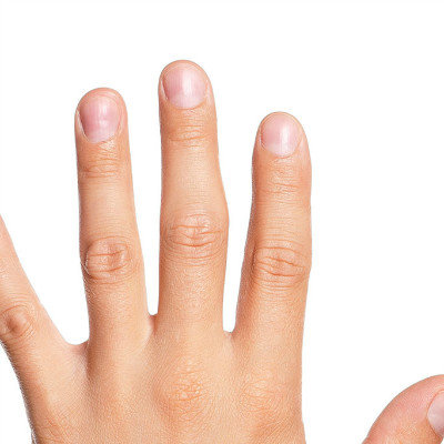 What medicine does finger nameless swelling use?